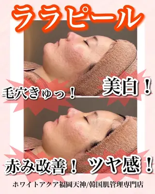 メンズ キッズ WHITEAQUA 福岡天神店のエステ・リラクイメージ