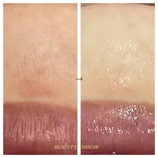 ビューティー ミロワールのエステ・リラクイメージ