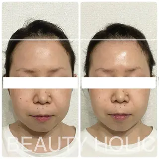 ニキビ・ 肌荒れ専門店のエステ・リラクイメージ