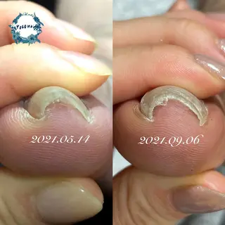 ネイル roconail ヒロコのネイルデザイン