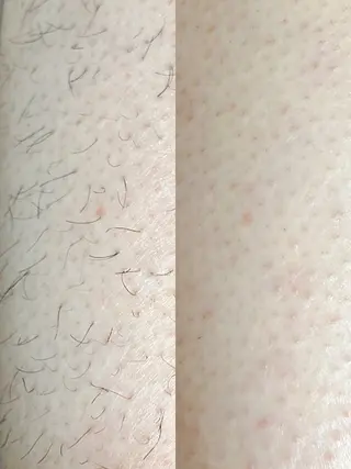 Hit. シュガーリング豊橋のエステ・リラクイメージ