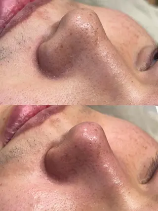 sii センター北 AIのエステ・リラクイメージ