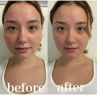 美容鍼灸サロン mahoroba院長のエステ・リラクイメージ