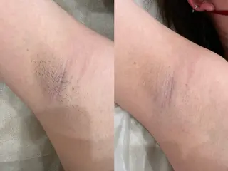 エステサロンTug高知駅前店所属・Tug 高知駅前店/ NANAMIのその他イメージ