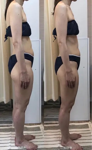 脱毛｜肌質改善｜ ROOM.Sのエステ・リラクイメージ