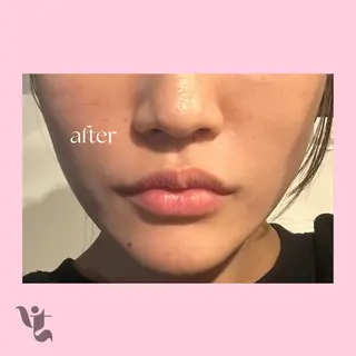 【vidyto】ヴィディトゥ所属・肌管理サロン vidyto MOEのエステ・リラクイメージ