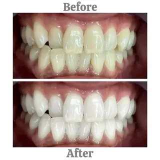 セルフホワイトニング　エクシア相模大野店所属・セルフホワイトニング エクシア相模大野店のその他イメージ