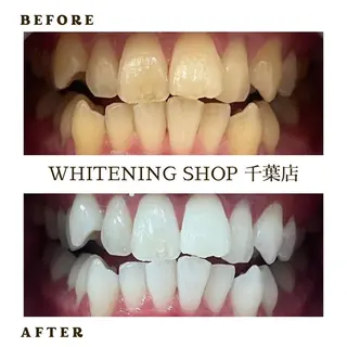 メンズ ホワイトニング ショップ千葉店のその他イメージ