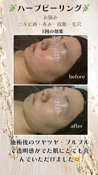 リンパケアサロン 🧡Relairのエステ・リラクイメージ