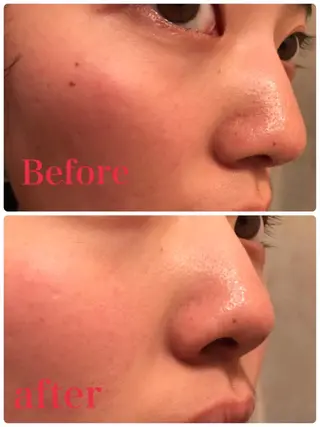 リラクゼーションエステサロン🌺肌質改善イアリイ所属・肌質再生 〜イア🌺リイ〜のエステ・リラクイメージ