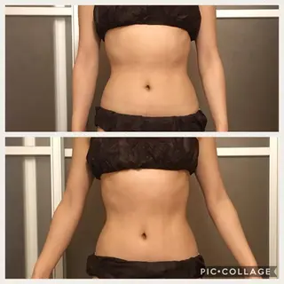 ショート カラー パーマ ヘアアレンジ メンズ キッズ ネイル マツエク・マツパ アニメ,Vオタク× 即効痩せエステサロンのエステ・リラクイメージ