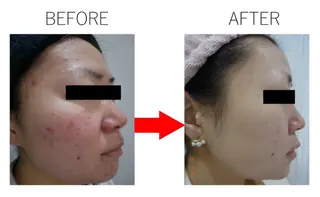 肌質改善専門サロン 川島 彩のエステ・リラクイメージ