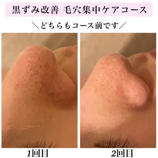 Bellesthe (ベルエステ)のエステ・リラクイメージ