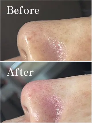 枝廣 貴子のエステ・リラクイメージ