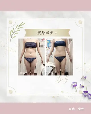 痩身専門エステ addissimoのエステ・リラクイメージ