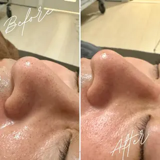 美肌salon GRAN CUORE所属・Natsuki🌙 GRAN CUOREのエステ・リラクイメージ