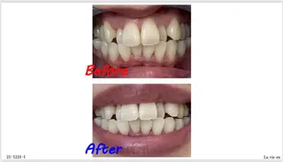 セルフホワイトニングサロン　ラヴィアン所属・ホワイトニングサロン La vie enのその他イメージ