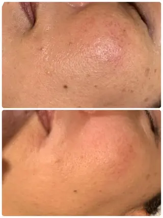 esty hitomiのエステ・リラクイメージ