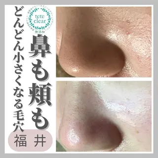 毛穴ケア専門サロン Yourmeユアミーのエステ・リラクイメージ