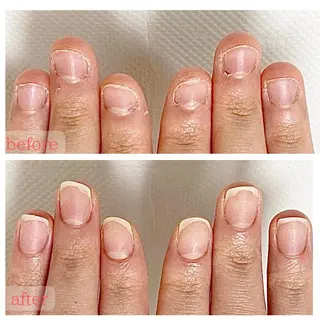 ネイル 深爪・巻き爪 専門サンセリテのネイルデザイン