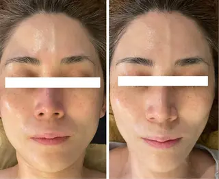 耳ツボ/体質改善/ 温活La mer月島のその他イメージ