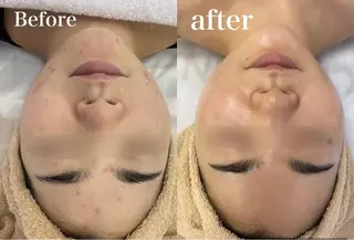 OOPARTS所属・大塚 杏美のエステ・リラクイメージ