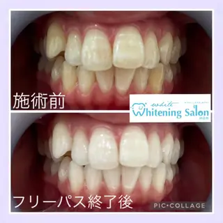 ショート メンズ キッズ ネイル マツエク・マツパ ホワイトニング&アイラッシュ四日市ホワイト所属・アイラッシュ ホワイトニング四日市のマツエク・マツパデザイン