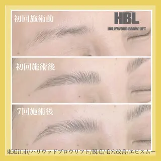 メンズ アイブロウ epismoo 脱毛/HBL/毛穴の眉毛・アイブロウイメージ