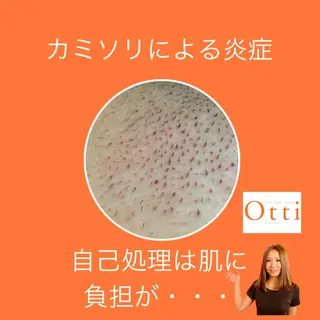 エステ脱毛サロン Otti  オッティのエステ・リラクイメージ