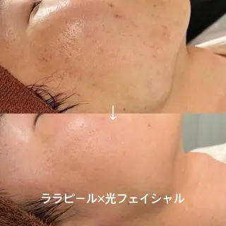 LEPUS （レプス）sasaのエステ・リラクイメージ