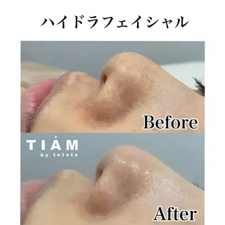 美肌サロンTIAM by tetoteのエステ・リラクイメージ