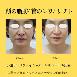 ユニセックスエステサロンUniclear所属・男女エステユニクリア Uniclearのエステ・リラクイメージ