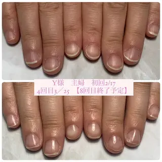 ネイル AKT NAIL所属・AKT Beauty エステヘッドスパのエステ・リラクイメージ