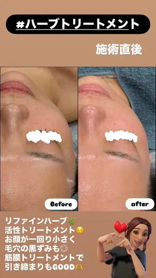 LiZA エステティックサロンのエステ・リラクイメージ