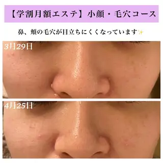 Bellesthe (ベルエステ)のエステ・リラクイメージ