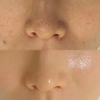 Whitening Beauty 行橋店所属・Whitening Beauty 行橋店のその他イメージ