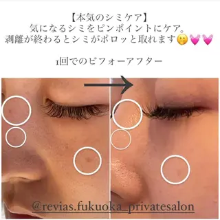 シミケアサロン REVIASオーナーのエステ・リラクイメージ