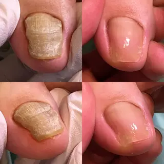 東京巻き爪アカデミー所属・東京巻き爪 アカデミーのエステ・リラクイメージ