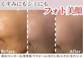 sii センター北 AIのエステ・リラクイメージ