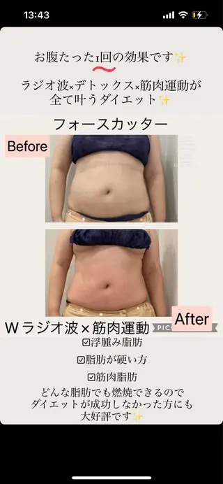 ブライダル痩身×脱毛 尼崎駅前サロンのエステ・リラクイメージ