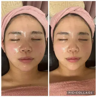 メディカルエステ　痩身·小顔専門サロンBBC 田園調布所属・KEI KOのエステ・リラクイメージ