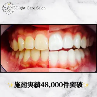 ホワイトニング専門店 LCS 銀座店 峰岡のその他イメージ