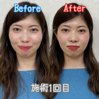 整体 LALUZ中目黒のその他イメージ