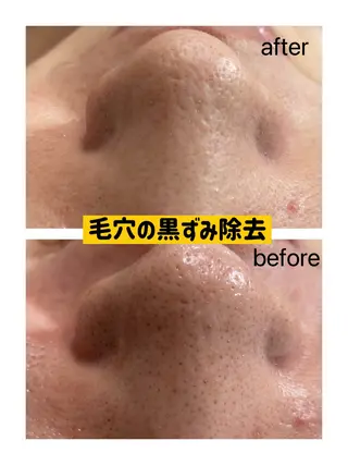 はせがわ せりなのエステ・リラクイメージ