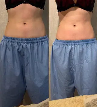 腸活サポート みなみののエステ・リラクイメージ