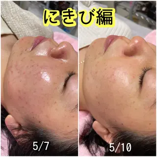 毛穴レス ハーブ& ワックス脱毛×光脱毛のエステ・リラクイメージ