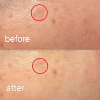 痛くないシミ取り 【荻窪】石橋のヘアスタイル