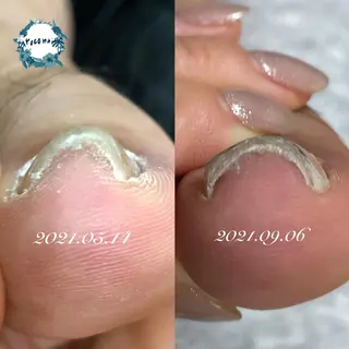 ネイル roconail ヒロコのネイルデザイン