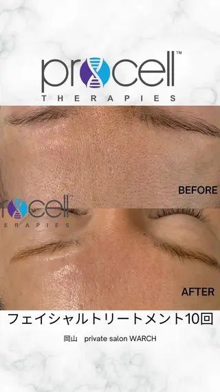 WARCH Marieのその他イメージ