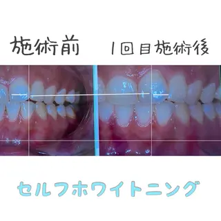 🦋Kiyomi. 🦋のネイルデザイン